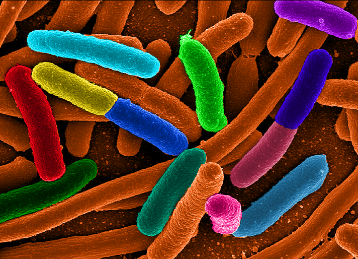 E coli bacteria