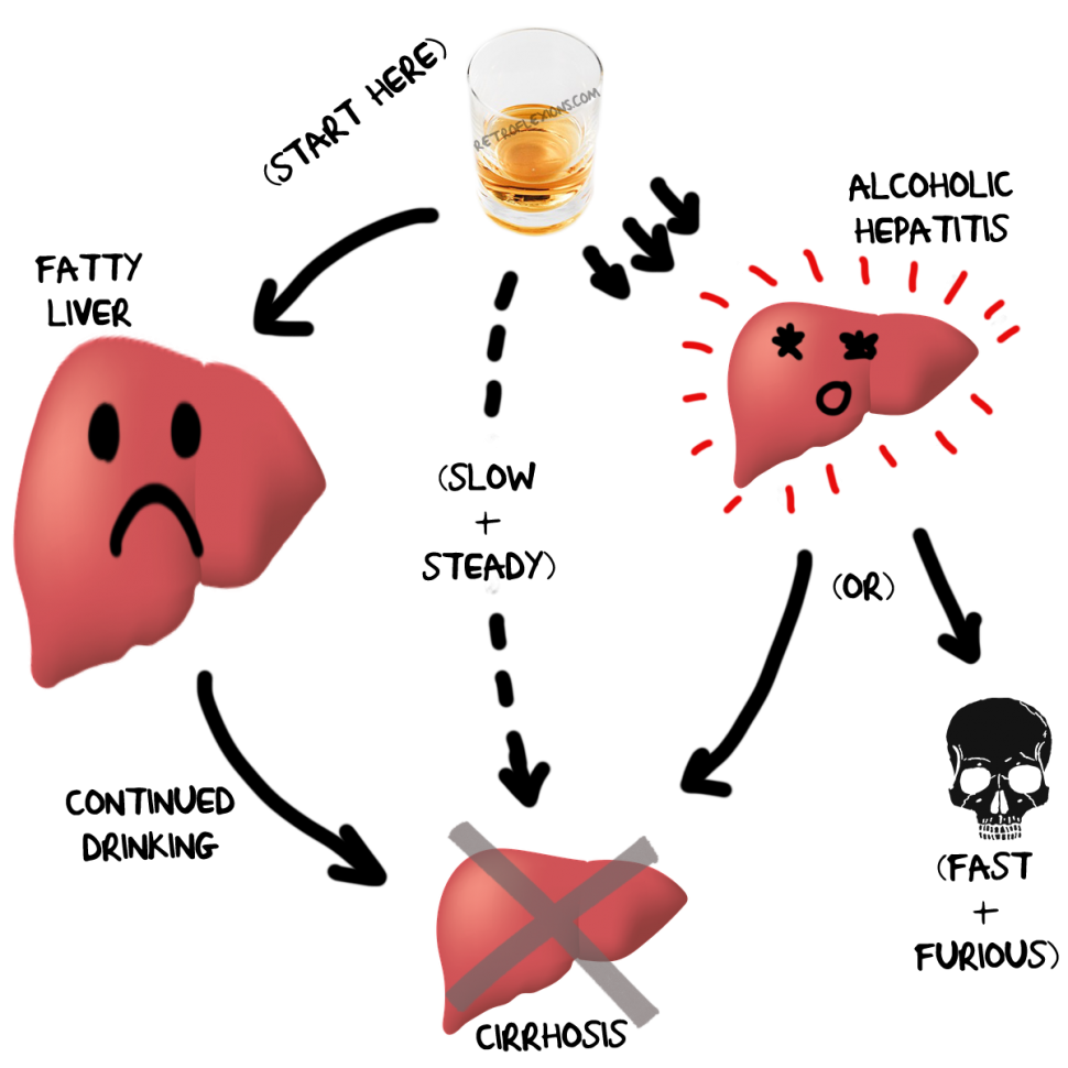 » How exactly does alcohol cause liver problems?