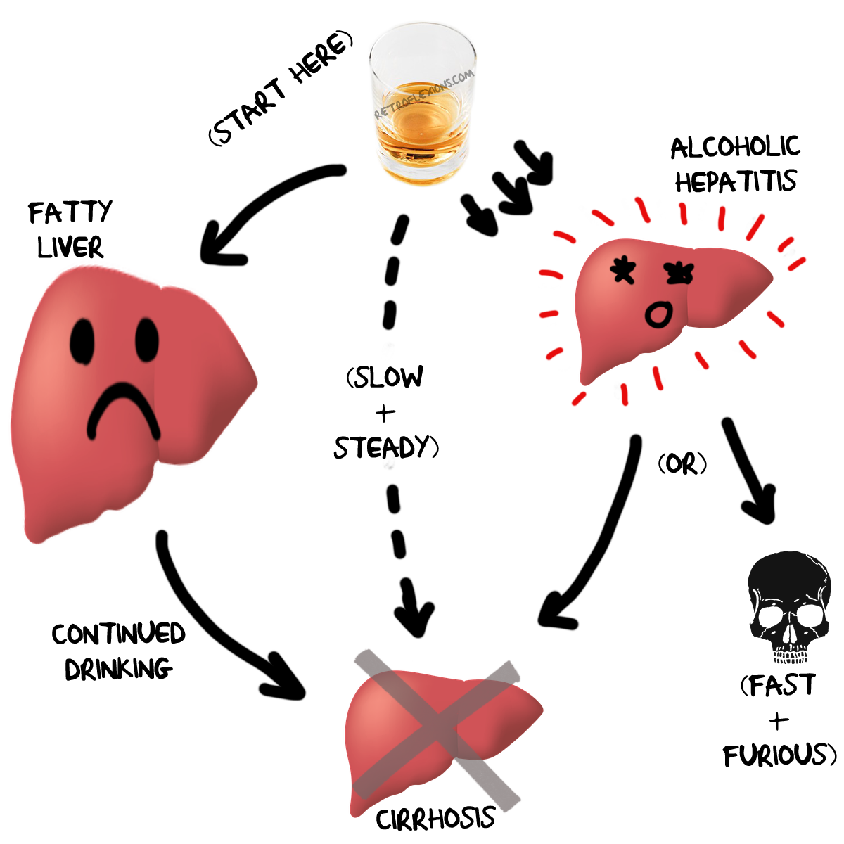 How Exactly Does Alcohol Cause Liver Problems? | Retroflexions.com